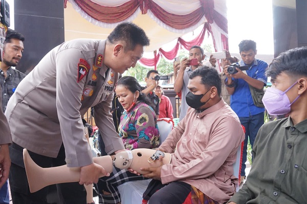 Kaki Palsu Kapolda Riau Untuk Penyandang Disabilitas di Rohil