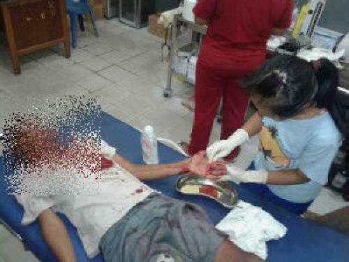 Bongkar Kios, Bocah Umur 14 Tahun di Siak Bonyok Dihakimi Warga