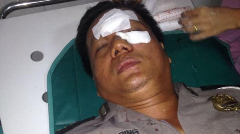 Terima Uang 150 Ribu, Kanit Lantas Polsek Sunggal Dianiaya