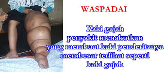  Sukseskan Program Pemberian Obat Filariasis Massal, Pemkab Inhu Gelar Rakor